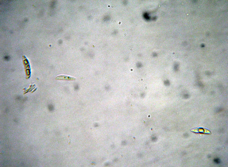 Forse non � Hymenoscyphus fructigenus ....